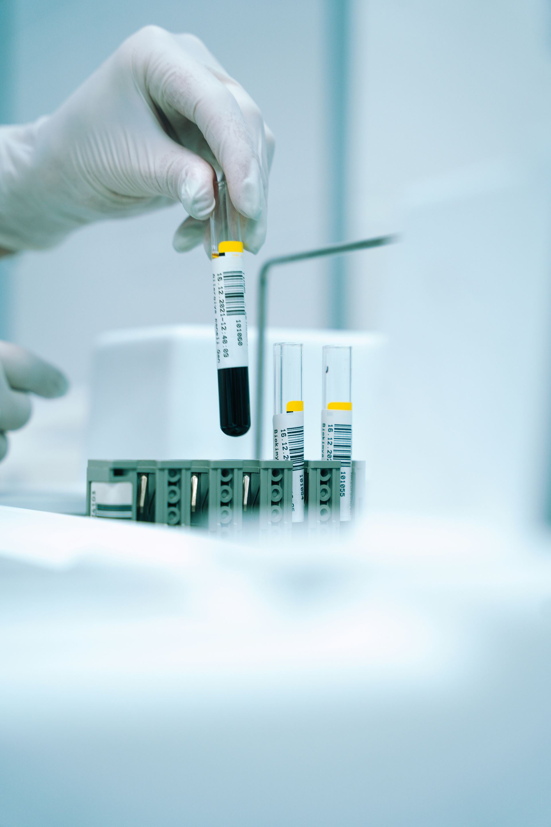 test tubes being tested in a laboratory